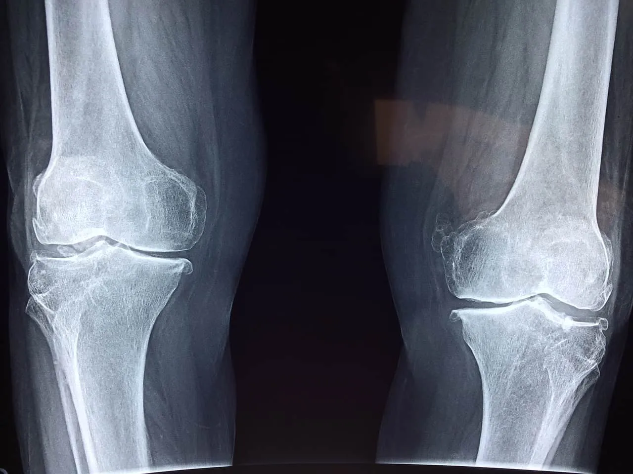 Knees 1544551475
