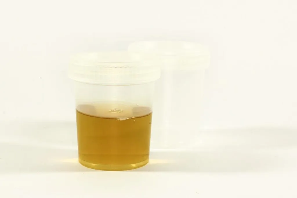urine 1548088100 שתן בכוס