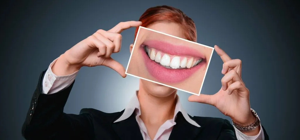 Teeth 1623761142 אישה לאחר הלבנה