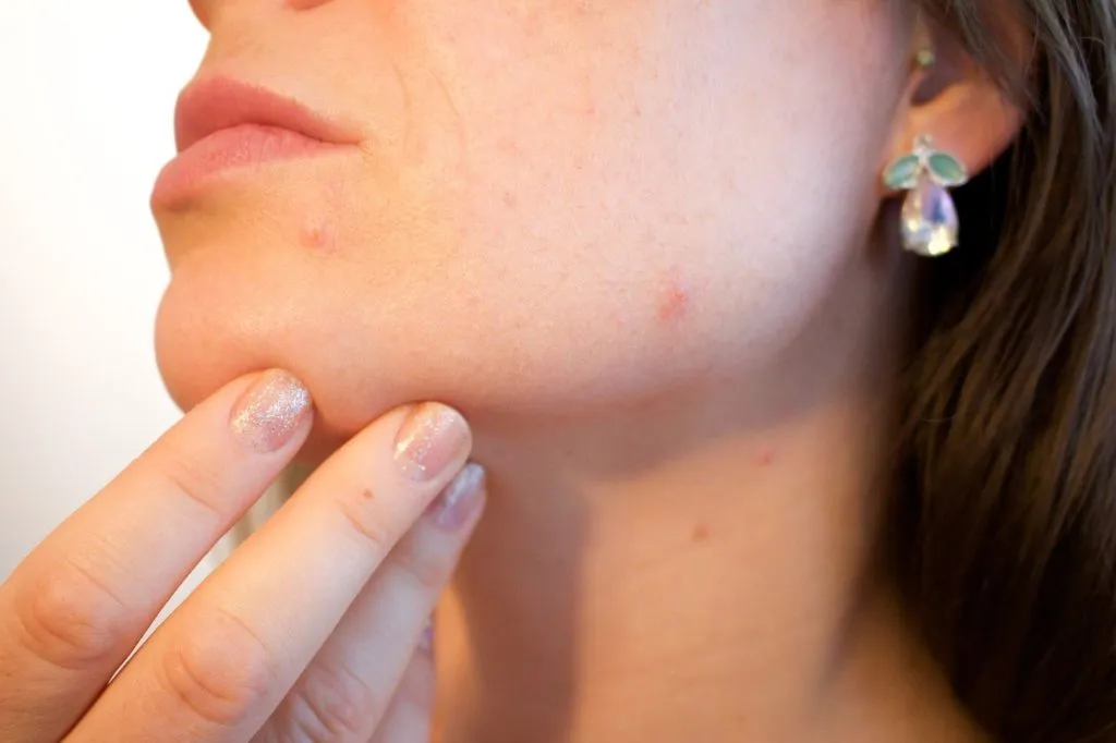 facial treatment 1639567921 פצעים