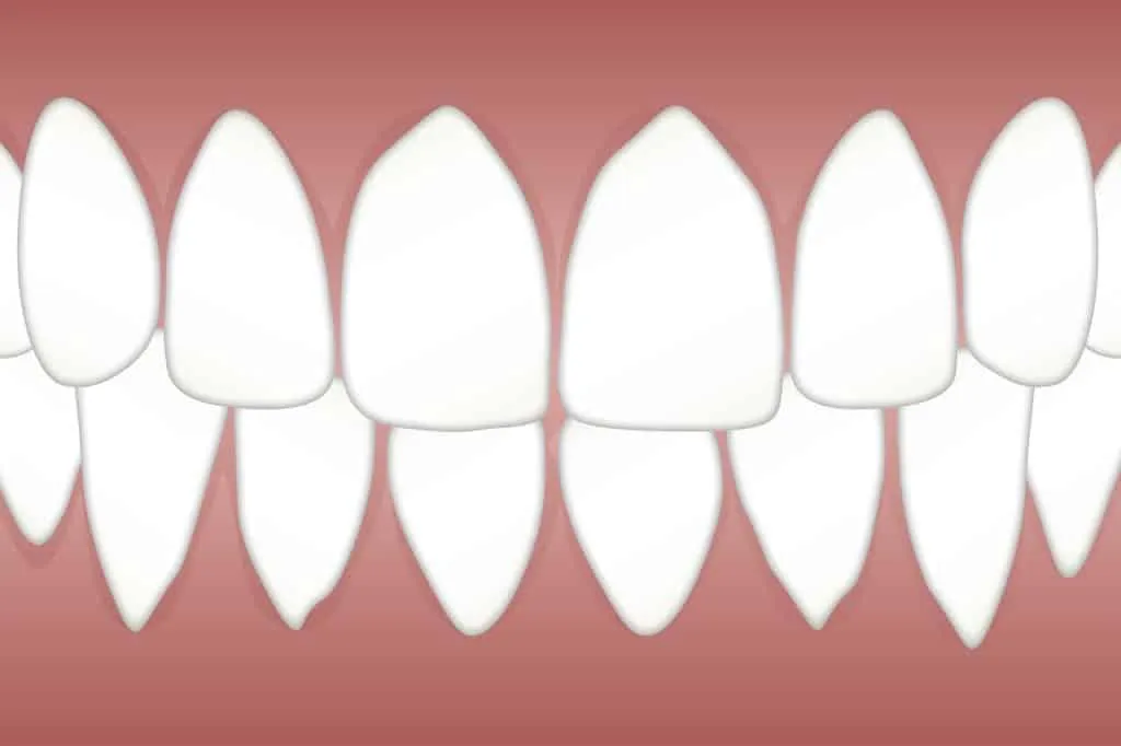 Dental care 1637766938 חיוך